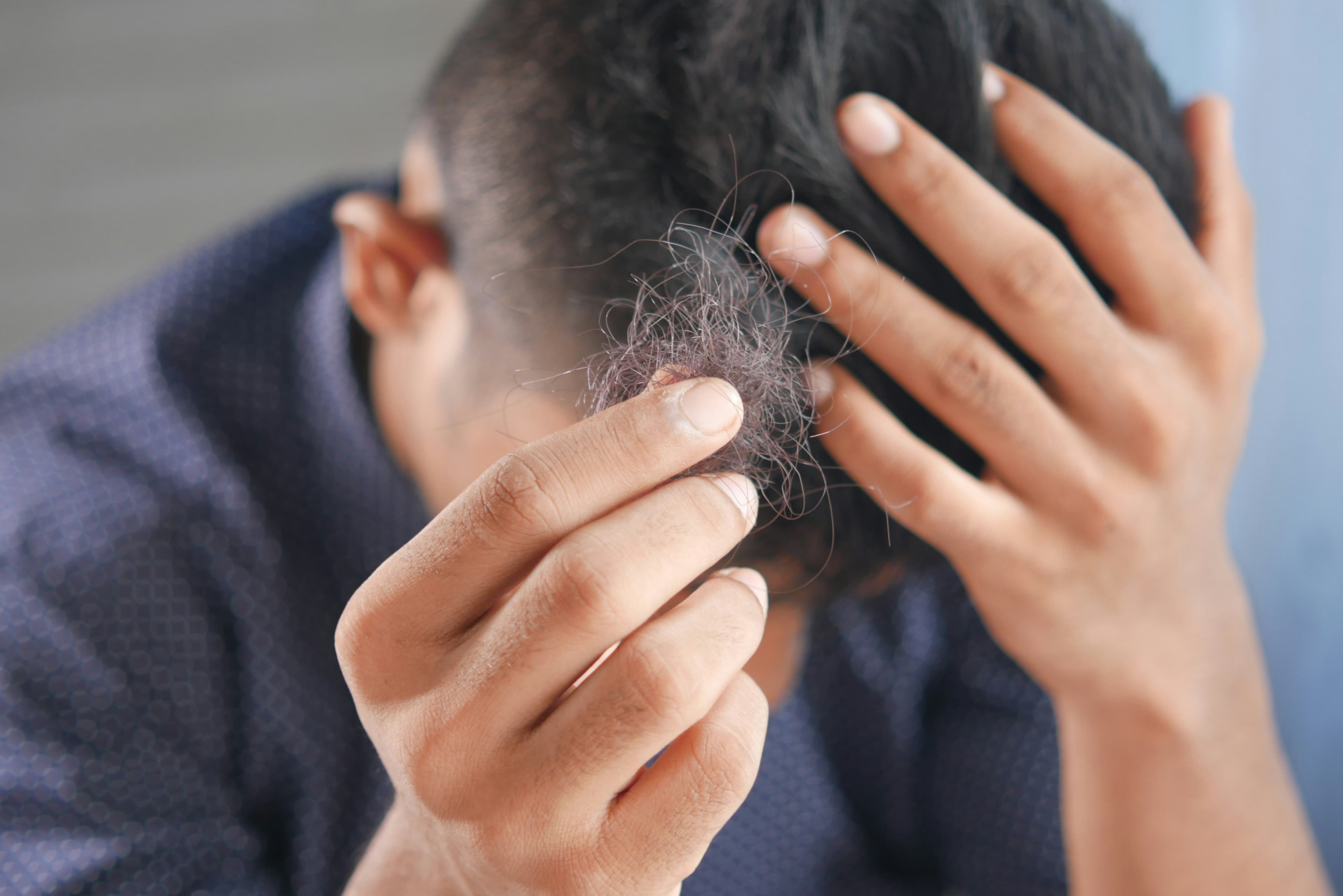Pourquoi perd-on plus de cheveux en automne ?