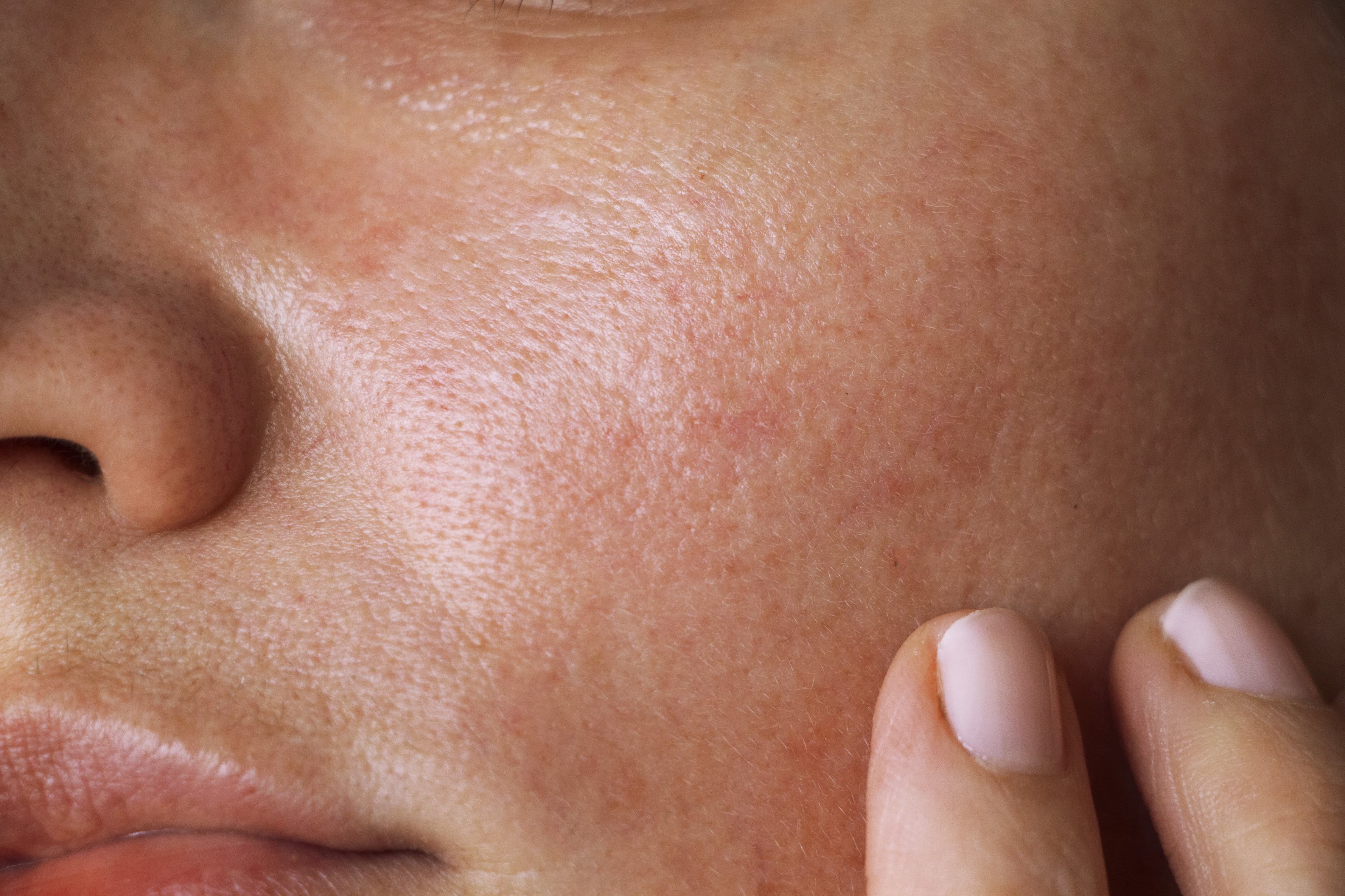 Pourquoi les antioxydants sont-ils essentiels pour la peau ?