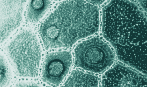Prébiotiques, probiotiques et postbiotiques : différences, bienfaits et sources naturelles